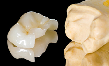 Zahnarzt Maintal, Zahnarztpraxis Maintal, Konservierende Zahnmedizin / Füllungstherapie